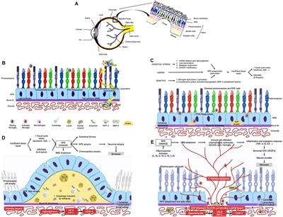 Biotechnology and Biomaterial-Based Therapeutic Strategies for Age-Related Macular Degeneration. Part I: Biomaterials-Based Drug Delivery Devices